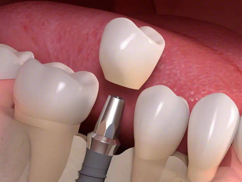 About Pure Dentistry Arts