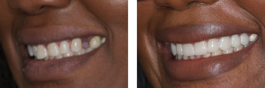 Before and after photo