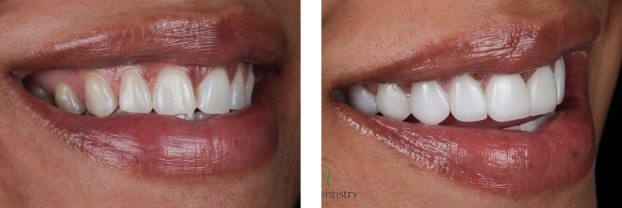 Before and after photo