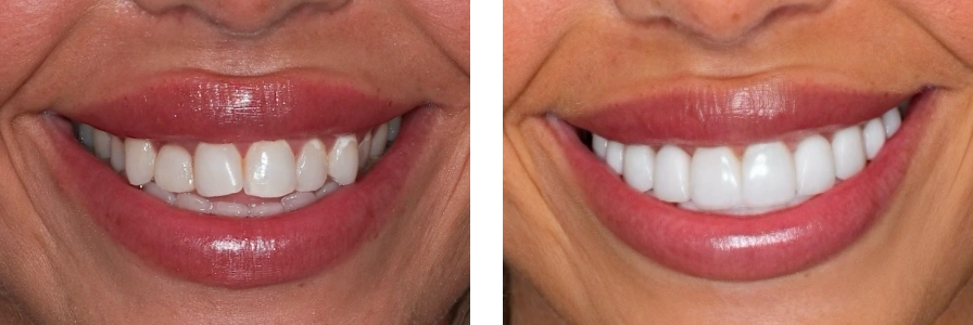 Before and after photo