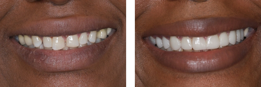 Before and after photo